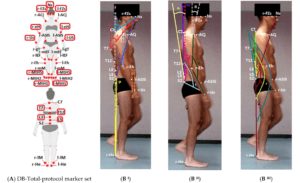 A new kinematic protocol for evaluating sagittal posture during walking-the DB-Total protocol