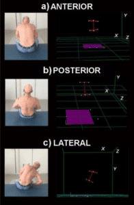 trunk-recovery-in-stroke-patients-using-3d-kinematic-analysis-a-useful-tool-to-improve-neurological-rehabilitation